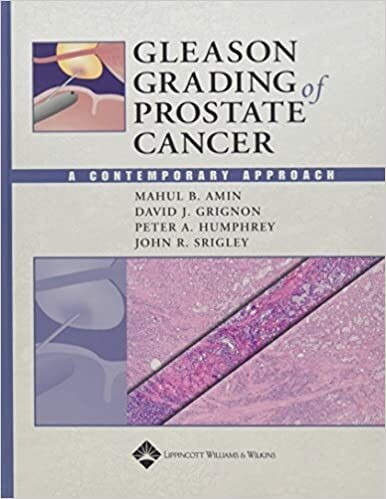 Gleason Grading of Prostate Cancer: A Contemporary Approach 1st Edition