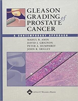 Gleason Grading of Prostate Cancer: A Contemporary Approach 1st Edition