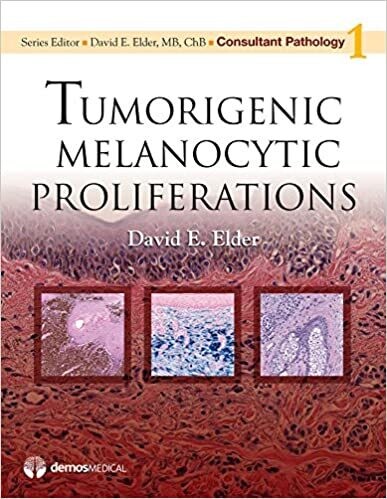 Tumorigenic Melanocytic Proliferations (Consultant Pathology Book 1) 1st Edition