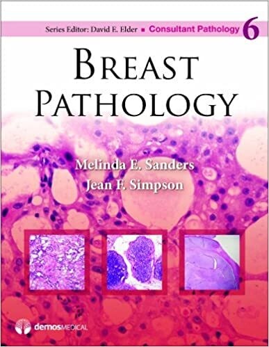 Breast Pathology (Consultant Pathology, Volume 6) 1st Edition
