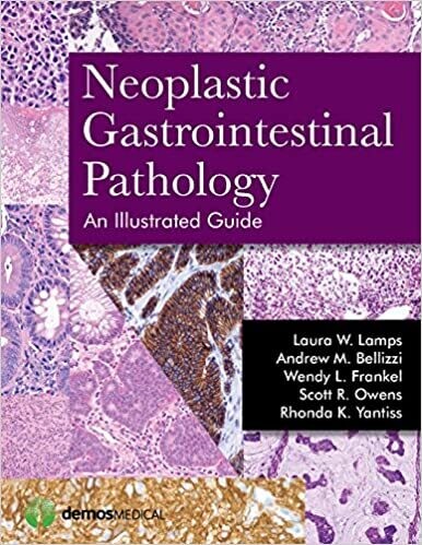 Neoplastic Gastrointestinal Pathology: An Illustrated Guide 1st Edition