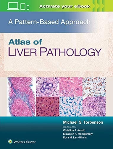 Atlas of Liver Pathology A pattern- Based Approach
