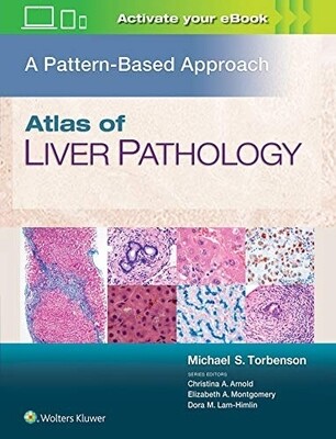 Atlas of Liver Pathology A pattern- Based Approach