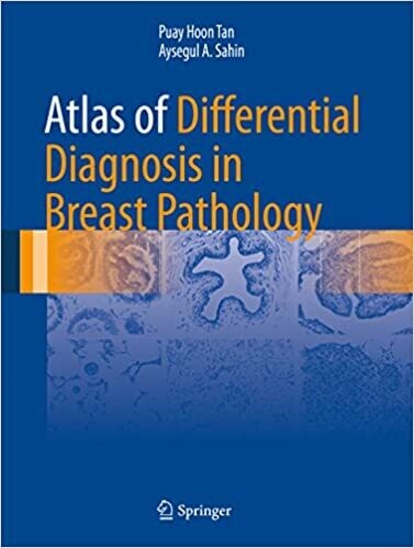 Atlas of Differential Diagnosis in Breast Pathology (Atlas of Anatomic Pathology) 1st ed. 2017 Edition