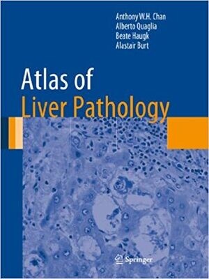 Atlas of Liver Pathology (Atlas of Anatomic Pathology) 2014th Edition