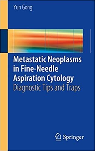 Metastatic Neoplasms in Fine-Needle Aspiration Cytology: Diagnostic Tips and Traps 1st ed. 2016 Edition,