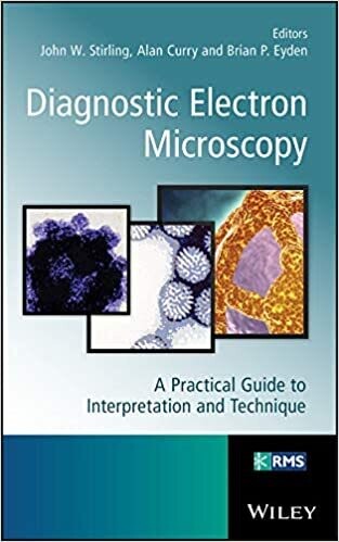 Diagnostic Electron Microscopy: A Practical Guide to Interpretation and Technique (RMS - Royal Microscopical Society) 1st Edition