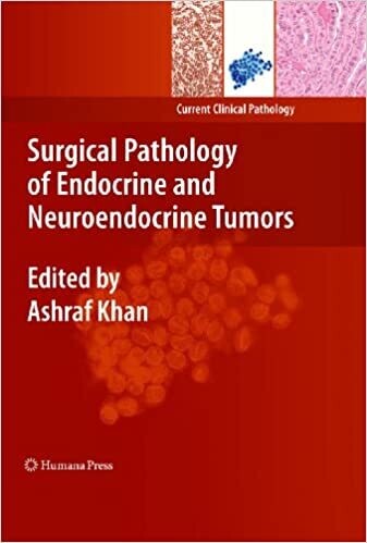 Surgical Pathology of Endocrine and Neuroendocrine Tumors (Current Clinical Pathology) 2009th Edition