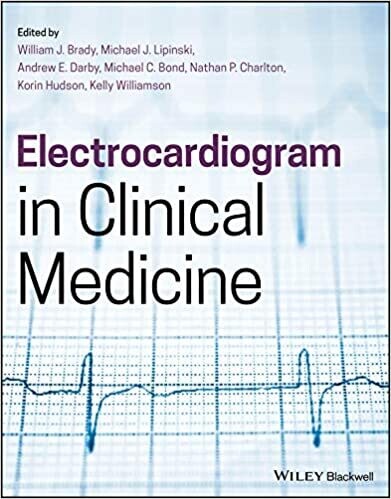 Electrocardiogram in Clinical Medicine 1st Edition