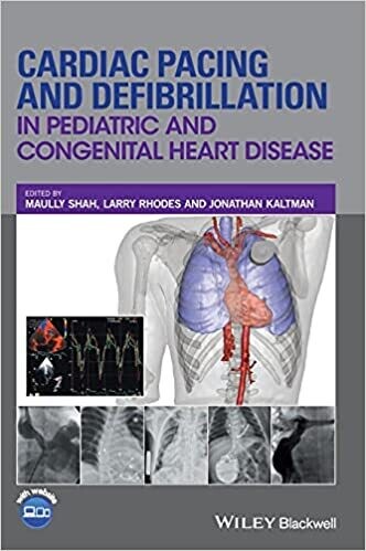 Cardiac Pacing and Defibrillation in Pediatric and Congenital Heart Disease 1st Edition