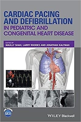 Cardiac Pacing and Defibrillation in Pediatric and Congenital Heart Disease 1st Edition