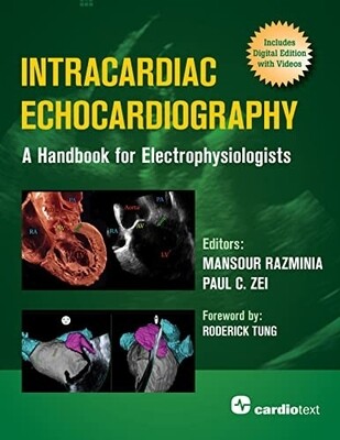 Intracardiac Echocardiography A Handbook for Electrophysiologists