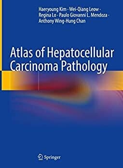 Atlas of Hepatocellular Carcinoma Pathology