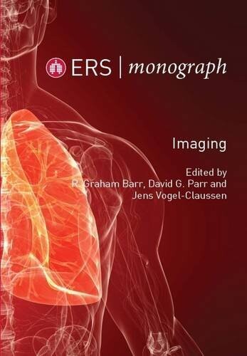 Imaging (ERS Monograph 70)