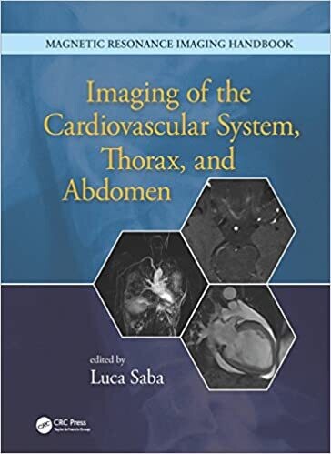 Imaging of the Cardiovascular System, Thorax, and Abdomen (Magnetic Resonance Imaging Handbook) 1st Edition