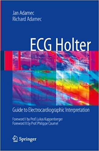 ECG Holter: Guide to Electrocardiographic Interpretation 2008th Edition