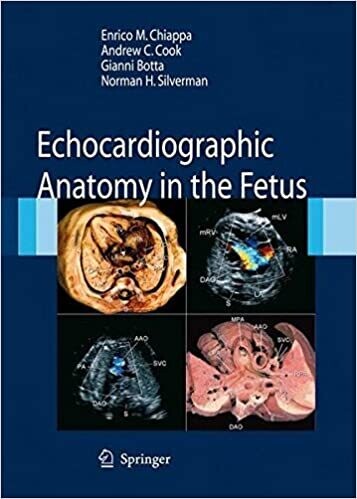Echocardiographic Anatomy in the Fetus 2008th Edition