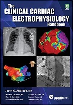 The Clinical Cardiac Electrophysiology Handbook 1st Edition