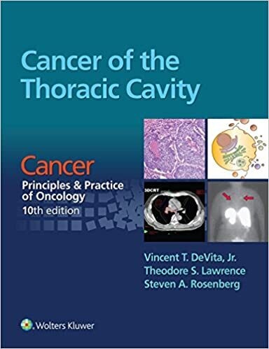 Cancer of the Thoracic Cavity: Cancer: Principles &amp; Practice of Oncology, 10th edition