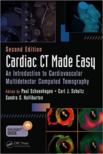 Cardiac CT Made Easy: An Introduction to Cardiovascular Multidetector Computed Tomography, Second Edition 2nd Edition