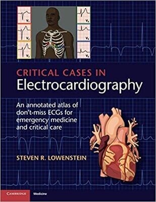 Critical Cases in Electrocardiography: An Annotated Atlas of Don&#39;t-Miss ECGs for Emergency Medicine and Critical Care 1st Edition