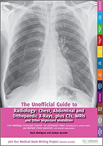 The Unofficial Guide to Radiology: Chest, Abdominal and Orthopaedic X Rays, Plus CTs, MRIs and Other Important Modalities: Core Radiology Curriculum (Unoffical Guides) 1st Edition
