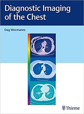 Diagnostic Imaging of the Chest 1st Edition