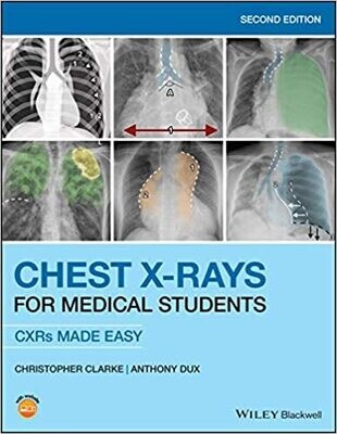 Chest X-Rays for Medical Students: CXRs Made Easy 2nd Edition