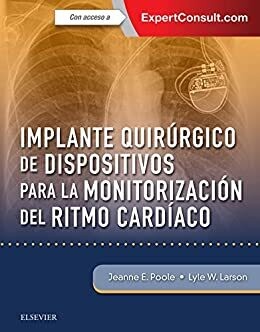 Implante quirúrgico de dispositivos para la monitorización del ritmo cardíaco (Spanish Edition)