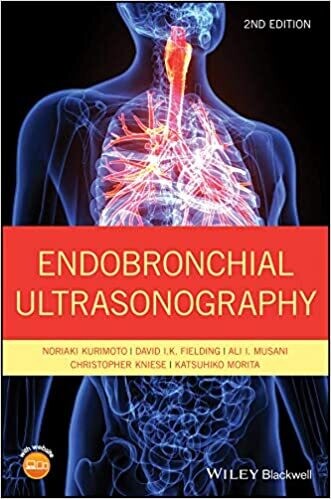 Endobronchial Ultrasonography 2nd Edition