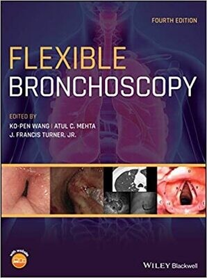 Flexible Bronchoscopy 4th Edition