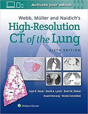 Webb, Müller and Naidich&#39;s High-Resolution CT of the Lung Sixth Edition