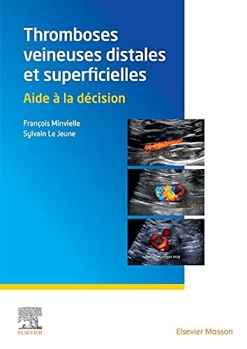 Thromboses veineuses distales et superficielles: Aide à la décision (French Edition)