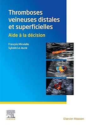 Thromboses veineuses distales et superficielles: Aide à la décision (French Edition)