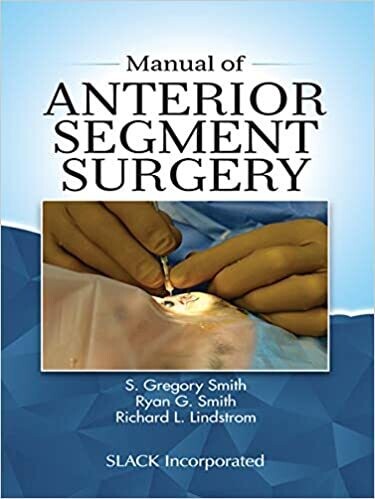 Manual of Anterior Segment Surgery 1st Edition