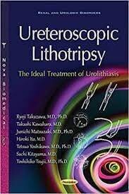 Ureteroscopic lithotripsy
