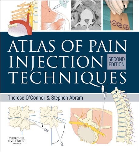 Atlas of Pain Injection Techniques: Expert Consult: Online and Print 2nd Edition