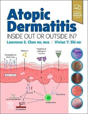 Atopic Dermatitis