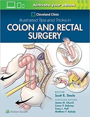 Cleveland Clinic Illustrated Tips and Tricks in Colon and Rectal Surgery 1st Edition
