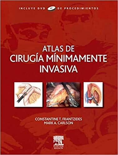 Atlas de cirugía mínimamente invasiva + DVD-ROM (Spanish Edition)