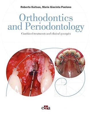 Orthodontics and Periodontology: Combined treatments and clinical synergies