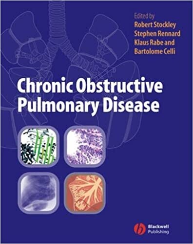 Chronic Obstructive Pulmonary Disease 1st Edition