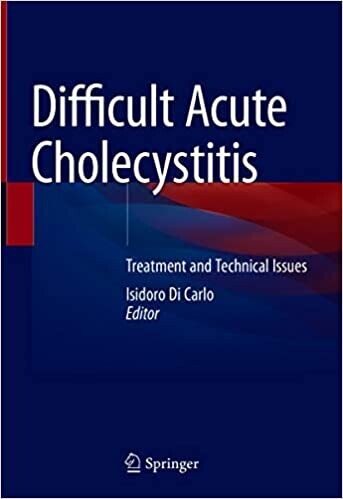 Difficult Acute Cholecystitis: Treatment and Technical Issues 1st ed. 2021 Edition
