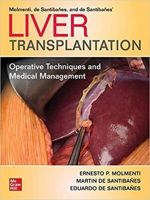 Liver Transplantation: Operative Techniques and Medical Management 1st Edition