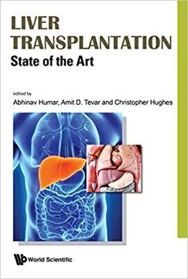 Liver Transplantation: State Of The Art (Gastroenterology) 1st Edition