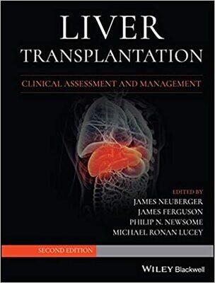 Liver Transplantation: Clinical Assessment and Management 2nd Edition