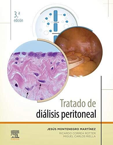 Tratado de diálisis peritoneal (Spanish Edition)