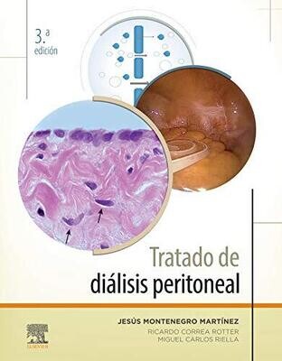 Tratado de diálisis peritoneal (Spanish Edition)