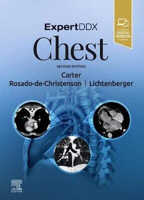 ExpertDDx Chest 2nd Edition