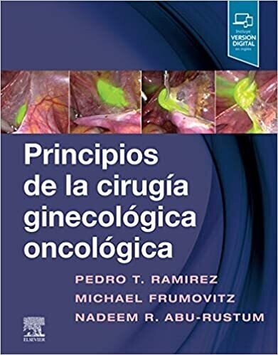 Principios de la cirugía ginecológica oncológica (Spanish Edition) 1st Edition